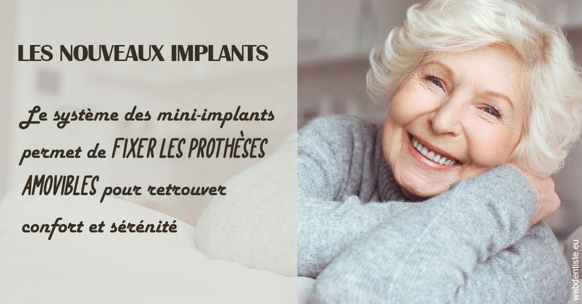 https://dr-guigue-eric.chirurgiens-dentistes.fr/Les nouveaux implants 1