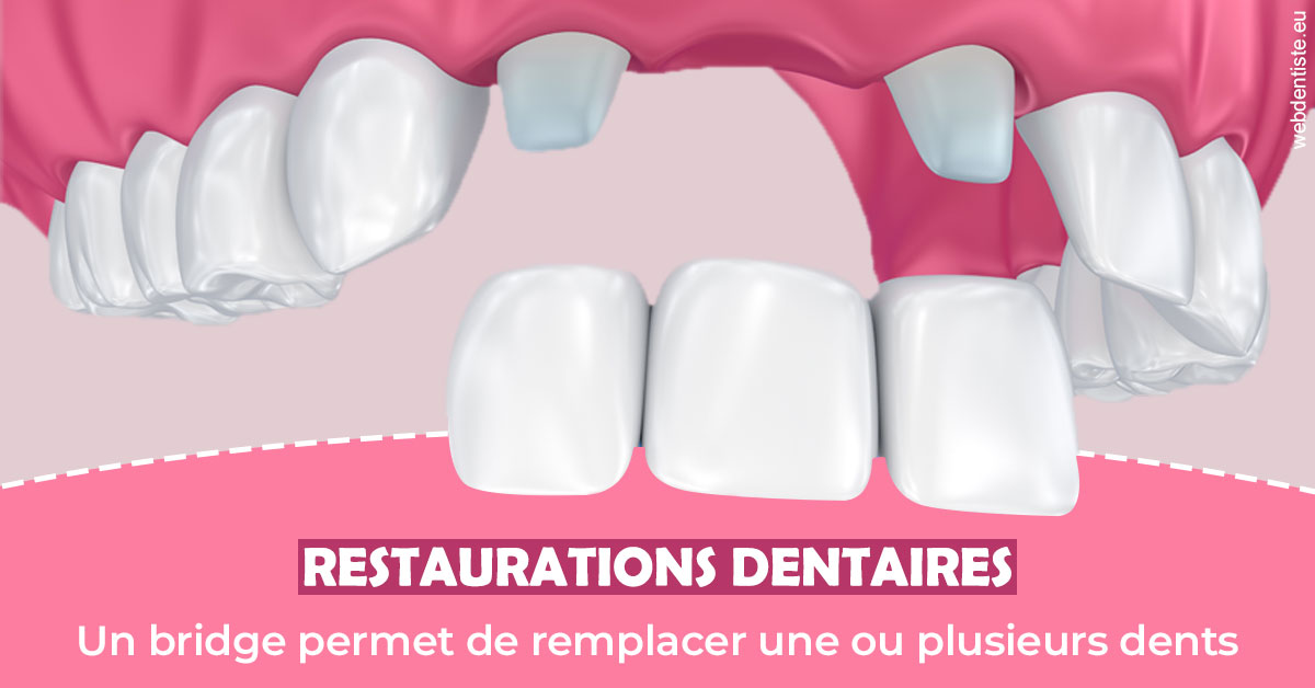 https://dr-guigue-eric.chirurgiens-dentistes.fr/Bridge remplacer dents 2